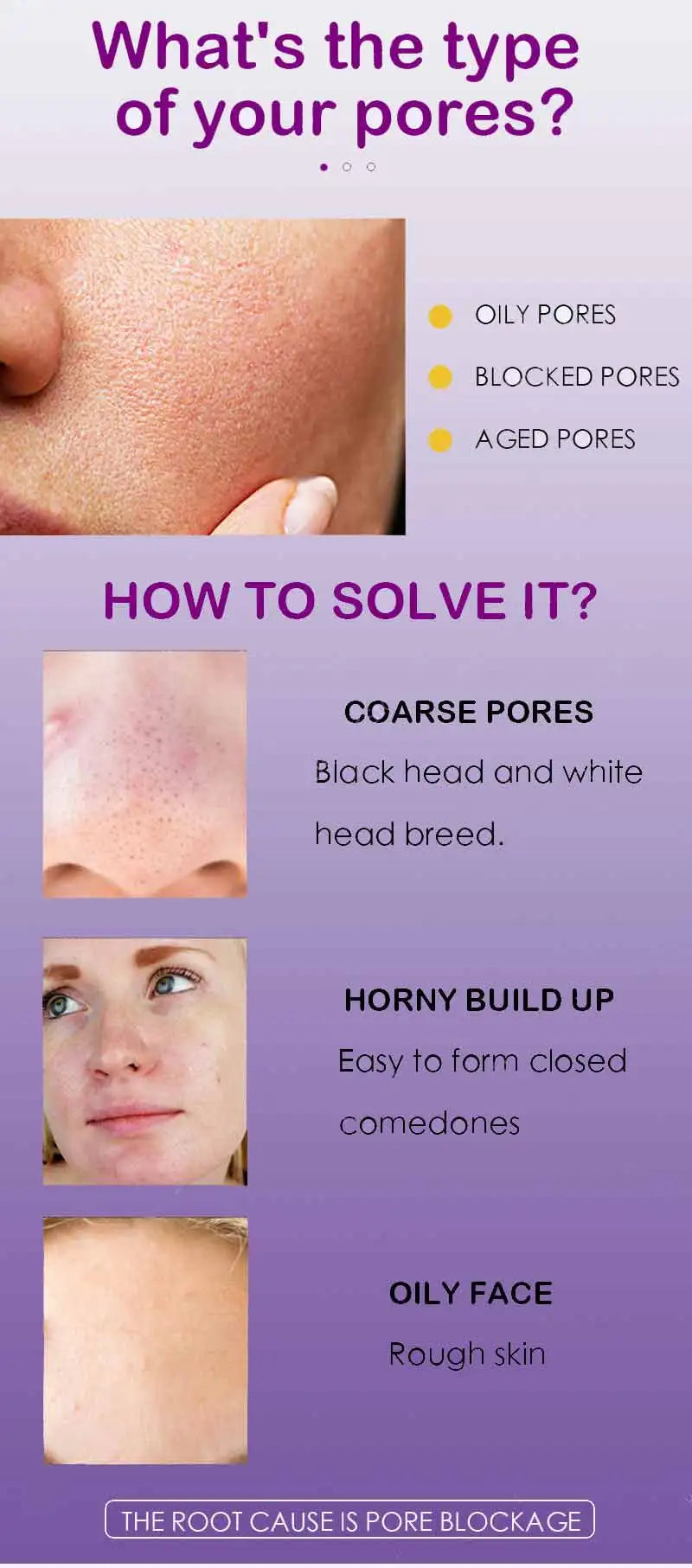 Pore Refining Skin Serum